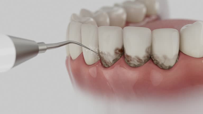 Trusted Teeth Cleaning And Checkup service in Bolingbrook, IL - Dentist Open Now